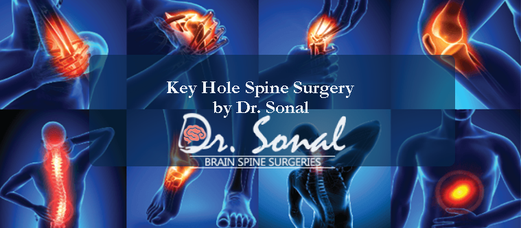 Key hole Spine Surgery