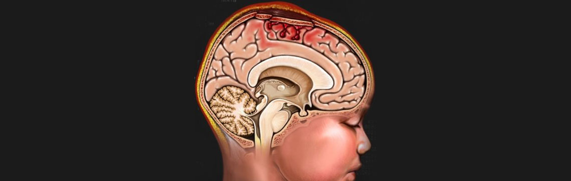 Head Injury Treatment